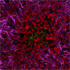 Image Listeria monocytogenes infection