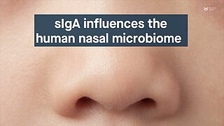 Secretory immunoglobulin a affects microbial density in the human nose - Unique nasal microbiome