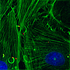 Bild Listeria monocytogenes infection